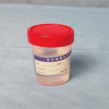 Specimen -container