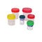 OEM OM OM ODM Laboratoriuminstrument Prijs Hematologie Analyzer Petri Dish Specimen Container