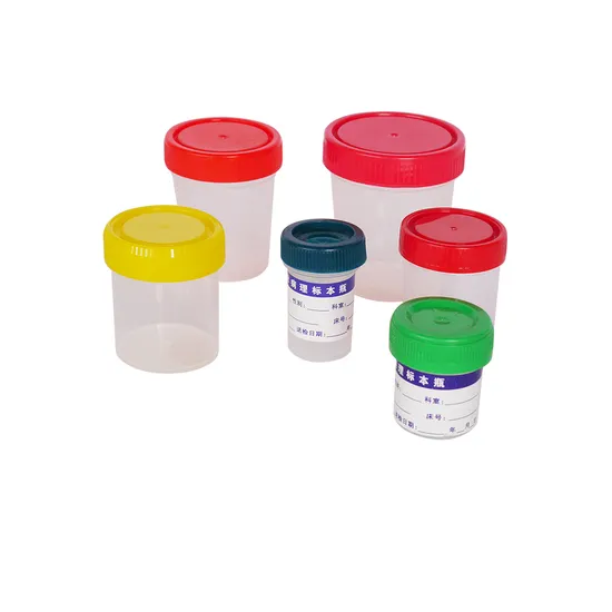 OEM OM OM ODM Laboratoriuminstrument Prijs Hematologie Analyzer Petri Dish Specimen Container